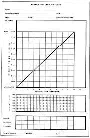 Image result for Active Management of Labor