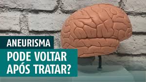 Um aneurisma cerebral pode vazar ou se romper, causando sangramento no cérebro (derrame hemorrágico). Aneurisma Cerebral Pode Voltar Apos Tratamento Youtube