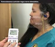Image result for can vagus nerve damage be reversed