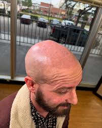 Spent the last week@in Houston at the infamous @scalpmicro_usa training