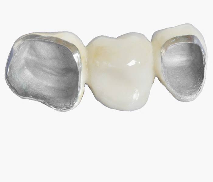 Regular PFM Crown product image