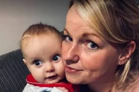 Baby George had two parts of his skull removed after a rare condition  caused it to grow abnormally