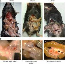 An der linden pj (1996). Mouse Model For Endometriosis Is Characterized By Proliferation And Inflammation But Not Epithelial To Mesenchymal Transition And Fibrosis Springerlink