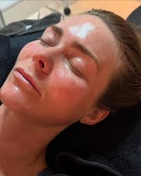 A skin experience, I treat all skin types and tailor your treatment to your  skins needs. Using quality products and technology to rejuvenate your skin.  Book in now. 🙏🏻