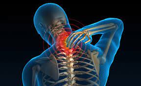 The bones provide a structural framework and protection to the soft organs. The Extreme Dangers Of Ignoring Upper Back And Neck Pain Longmont Spine Center
