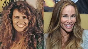 I had a surgery go wrong almost 4 years ago and since then my pain has gotten continually worse. Tawny Kitaen S Botched Plastic Surgery The Untold Truth
