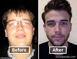 What losing 70 lbs did to my face pics. How To S Wiki 88 How To Lose Face Fat Reddit