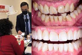 Become A Cosmetic Dentist With Composite Resin Veneers - October 12-13 -  Cosmedent