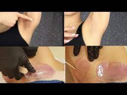 Private Body Parts Waxing Brighten Your Under Arms Under Legs Youtube