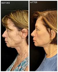 It's Red River Rivalry weekend and our LMD team is divided! ❤️🧡 Most of us  are cheering loud and proud for the Longhorns 🤘🐂, but we've got a few  brave OU fans