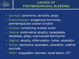 Vaginal bleeding is a particular concern in women older than age 50 years (or after menopause). Gynecology Suggestions For Lecturer 1 Hour Lecture Ppt Download