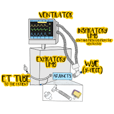 See full list on derangedphysiology.com Basics Of Dead Space Ventilation Criticalcarenow