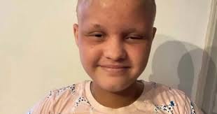 Schoolgirl lost sight in one eye and suffered oozing sores after using  eczema cream