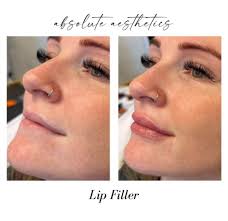 Jason Badgett RN added a new photo.