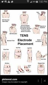 Placement Chart For Tens Pads Health Fibromyalgia