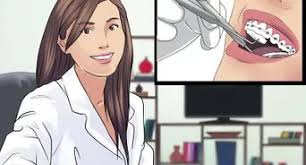 We did not find results for: 3 Ways To Whiten Your Teeth When You Have Braces Wikihow