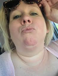 Laser hair removal in Lakeland for affordable options