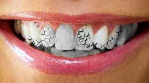 Has Sonado Que Se Caen Tus Dientes Aqui Te Explicamos Que Significa