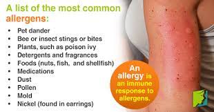 An Overview Of Allergies That Can Cause Itchy Skin Skin Allergy Allergies Pollen Allergies