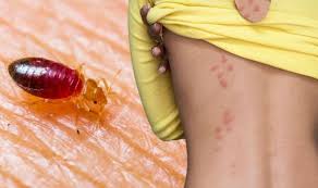 How to kill bed bugs with household items. Bed Bugs Get Rid Of Bed Bugs Using This Effective Method Have You Tried This Express Co Uk