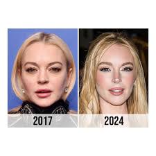 Lindsay Lohan's father, Michael Lohan, has publicly stated that his  daughter has never undergone plastic surgery. This comes amidst ongoing  speculation about her appearance over the years. According to him, any  changes