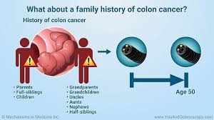 See full list on mayoclinic.org How Often Do You Have To Have A Colonoscopy After 50 How Repeatedly Should You Move A Colonoscopy