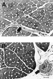 We did not find results for: Organization Of Motoneurons In The Dorsal Hypoglossal Nucleus That Innervate The Retrusor Muscles Of The Tongue In The Rat Mcclung 1999 The Anatomical Record Wiley Online Library