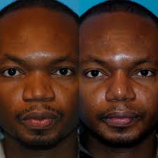 Profile for Romo Plastic Surgery