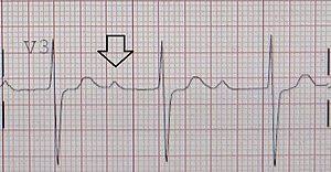 This game has been developed by fanatee games, a very famous video game company. Syncope Evaluation From Ecg A Check List And A Focused Review Dr S Venkatesan Md