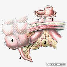 Ruckverlagerung Ileostoma Adventrum