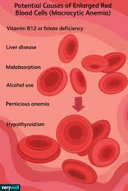Image result for Anemia angolensis