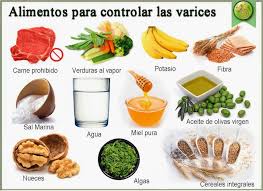 10 Remedios Caseros Para Las Varices