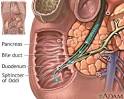 Clogged bile duct