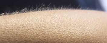 100% satisfaction guaranteed on all items Science May Have Finally Explained The Reason Why We Still Get Goosebumps