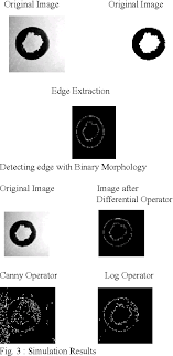 Pdf Various Methods For Edge Detection In Digital Image Processing Semantic Scholar