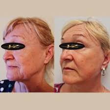 MUDr. Ján Zeleňák