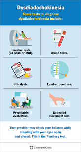 Image result for Rapid Alternating Movements