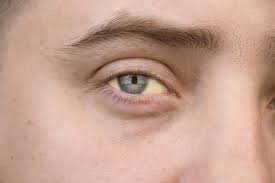 Gelbe Augen Bilder Und Stockfotos Istock