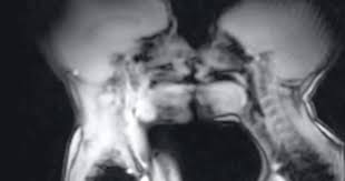 MRI video of couple having sex captured by the British Medical Journal -  Mirror Online