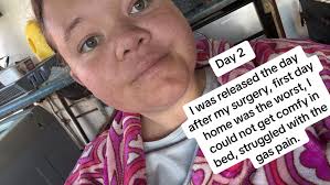 Day After Cholecystectomy