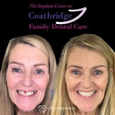 What is a Dental Implant?