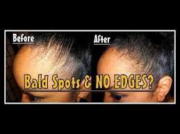 Pin On Styling Black Hair