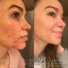 Sarah Burch- R+F Independent Consultant
