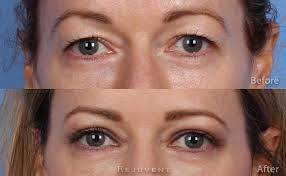 2000 mclain st ste f. Newport Eye Care Clinic Newport Ar Homes Of Heaven