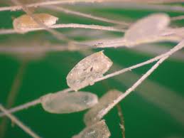 Nits may be difficult to see because they're very tiny. Sucking And Biting Lice Kentucky Pest News