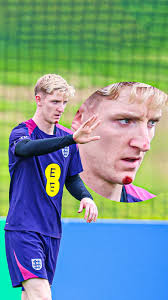 Anthony Gordon was sporting a graze