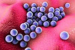 Wenn bakterien unempfindlich gegenüber vielen antibiotika sind, spricht man von multiresistenten erregern. Neue Impfstoffe Gegen Staphylococcus Results In Brief Cordis European Commission