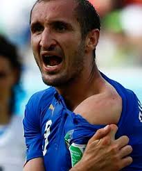 Fifa assistant referee david meier and the independent's james lawton discuss the suarez biting incident with stephen. Suarez At Centre Of Another Biting Scandal Stuff Co Nz