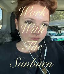 @Saie !!! I got SO burnt this weekend