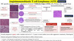 I'll post short song preview soon. Mohamed Jassim Md On Twitter Angioimmunoblastic T Cell Lymphoma Aitl Overview Hemepath Lymphoma Tcell Pathresident Pathology Pathtwitterfamily Https T Co Veljikiexi